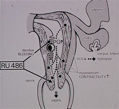 Mode d'action du ru486 (pilule abortive). Action du RU 486 au début de la grossesse - Assistance ...