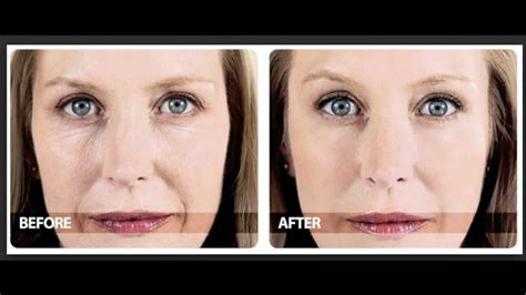 I am still a beginner. Phytoceramides Before And After - YouTube