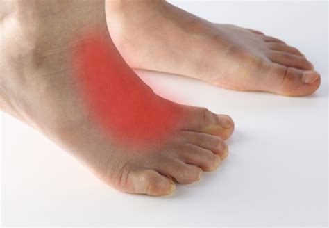 Step Up Your Foot Health: How to Treat Extensor Tendonitis – GatsbyShoes