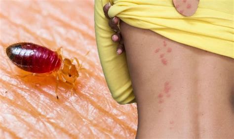 All our pest controllers are members of the british pest control association (bpca), the uk's leading trade association for pest control. Bed bugs: One effective way to get rid of an infestation ...