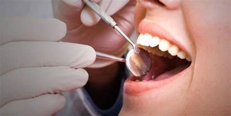 Rasa sakit itu disebabkan adanya lubang pada gigi yang semakin membesar dan dapat mempengaruhi saraf. Ubat Sakit Gigi Cara Tradisional - Rasmi Ro