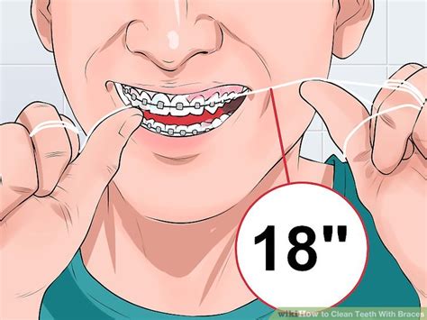 When you wear braces you often need to take extra care and pay additional attention to your teeth when you clean them, particularly if you have fixed or lingual braces. How to Clean Teeth With Braces: 12 Steps (with Pictures ...