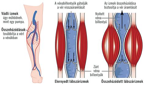 Minden, amit tudni érdemes a betegség okairól, tüneteiről és kezeléséről itt. Néz visszér ár. Lézeres visszérműtét (EVLA)