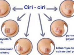 Saya bimbang tentang keadaan saya, doktor. Apa yang perlu diketahui mengenai kanser payudara dan ...