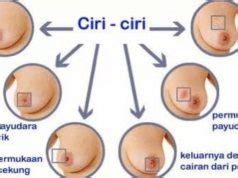 Lakukan pemeriksaan berkala ke atas payudara sendiri dan ketahui cara. Apa yang perlu diketahui mengenai kanser payudara dan ...