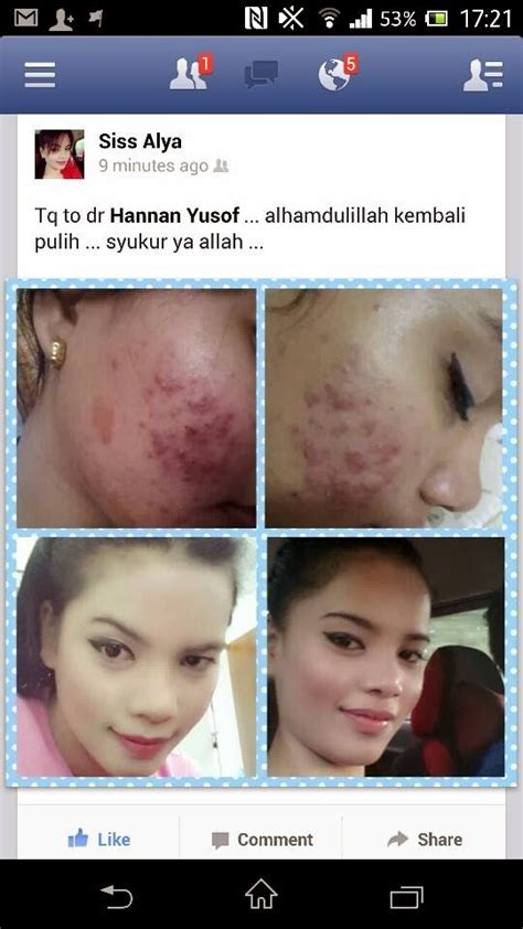 Kota bharu, occasionally written as kota baharu, is a city in malaysia that serves as the state capital and royal seat of kelantan. Hannan Medispa : rawatan jerawat Dr hannan KLINIK PRIMER ...