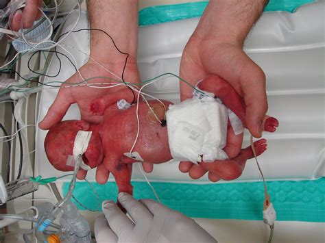 So you may like to wait two weeks to the first bath and by then gently. 24 Week Old Baby Development | Star Wars 101