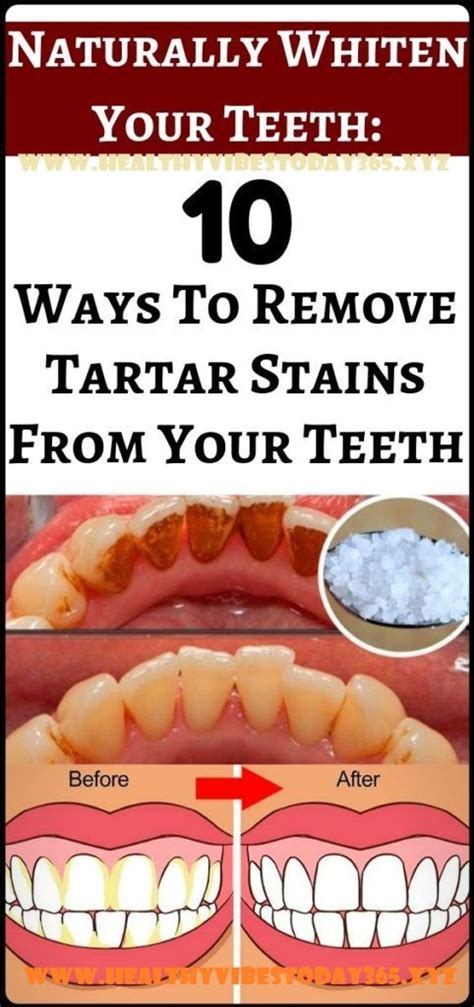 It helps to remove stains, but it's not so abrasive that it wears down your how do you prevent coffee from staining your teeth? Naturally Whiten Teeth: 10 Ways To Remove Tartar Stains ...