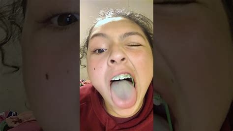 How to put on rubber bands on braces with nails. How to put rubber bands on braces - YouTube