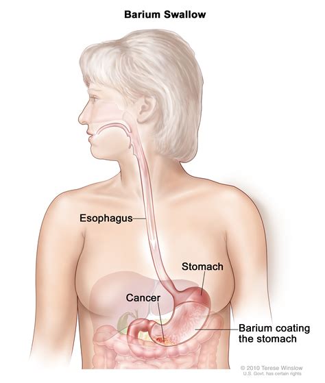 As with all cancers, being proactive about your health and your body can lead to a more positive result. Stomach (Gastric) Cancer Screening | MHealth.org
