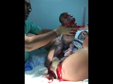 These videos do not have sound. video vaginal birth 10lbs 10oz baby Pi...fear tension pain ...