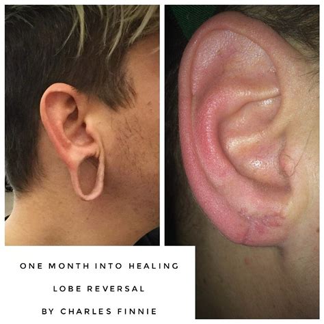 The camera might add 10 pounds, but now there's an app to fix that. Body Modification — Client sent me some progress photos of ...