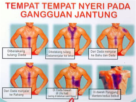 Pembengkakan di beberapa bagian tubuh bisa menjadi tanda bahwa jantung tidak memompa darah sebagaimana mestinya. Ciri Ciri Orang Terkena Penyakit Jantung Koroner - Obat ...