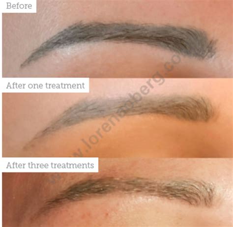 A tattoo can take as long as 6 months to heal completely. Eyebrow Tattoo To Remove How