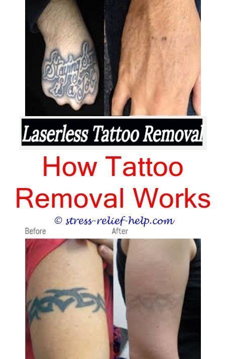 How to remove permanent tattoo at home in hindi. tattoo lightening is hair removal cream bad for tattoos ...
