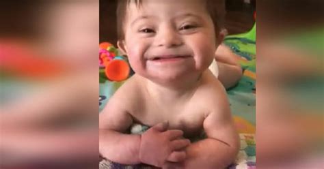 Children with down's syndrome have multiple malformations, medical conditions and cognitive impairment because of the presence of extra genetic material. Klippet som smelter hjerter: Her smiler adopteret baby med ...