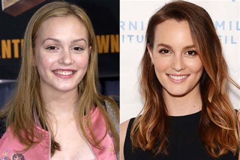 Cuidados com os dentes do bebé começam na gravidez. Antes e Depois - Infância do Elenco de Gossip Girl - Just ...