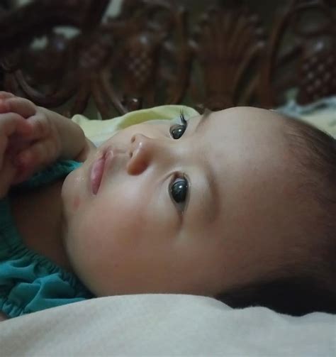 Ruam susu pada muka bayi: Ruam Pada Kulit Bayi Setelah Demam