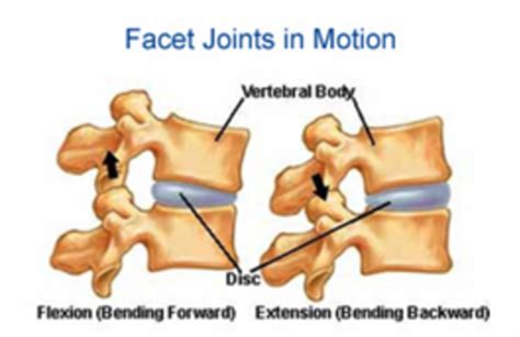 The disc often presses on a nerve root which can cause pain and other symptoms in a leg. SLIPPED DISCS: FIVE FACTS AND TWO BIG MISTAKES