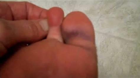 Maybe you would like to learn more about one of these? "i think i broke my big toe" Update - June 17, 2014 - YouTube