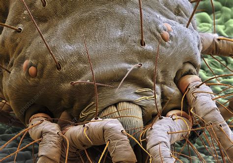 How serious are mite bites? Spider mite, SEM - Stock Image - C002/6214 - Science Photo ...