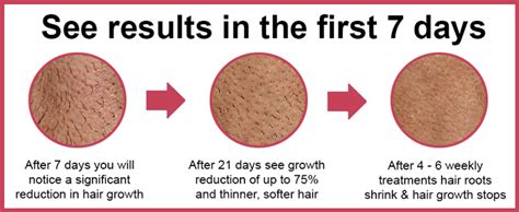 Repeat this process about three times per week. Hair terminator | Revolutionary Permanent hair remove and ...