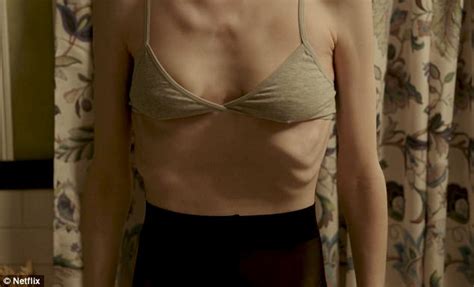 419 users · 7,720 views. Does Netflix movie To The Bone promote anorexia? | Daily ...