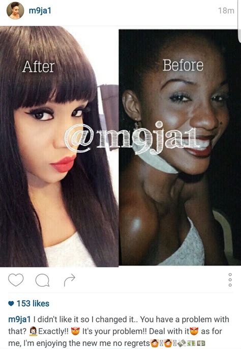 Vaginal bleaching has increased in popularity over the last few years. Maheeda shares before and after bleaching photos of herself