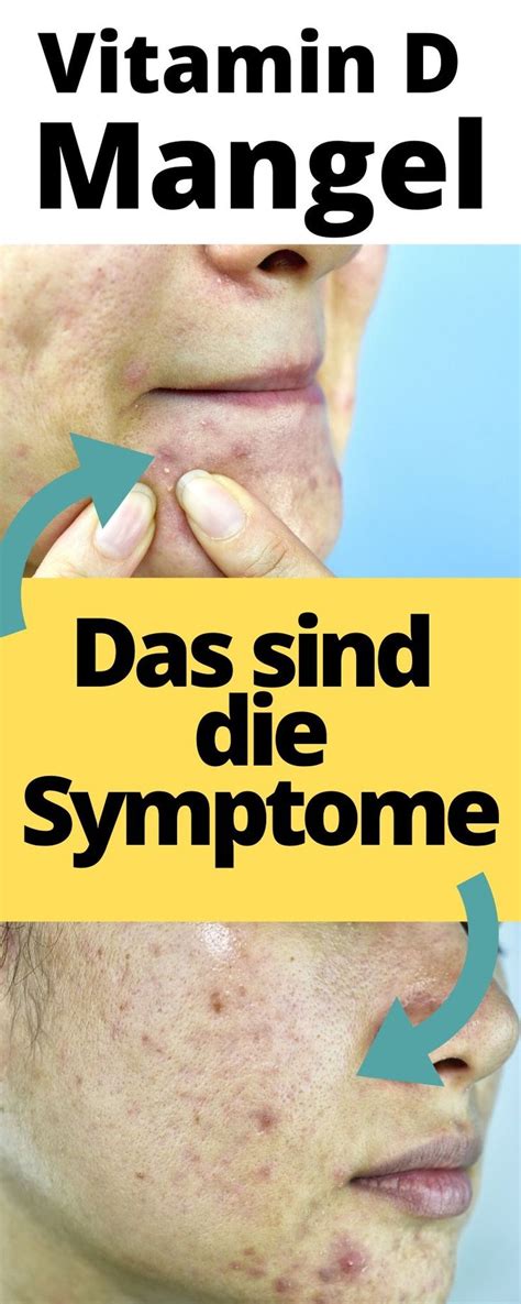 Bei anhaltendem vitamin d mangel: Die 7 eindeutigsten Anzeichen eines Vitamin D Mangels in ...