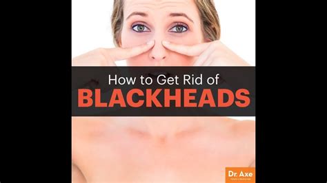 Some said they use lanolin and that helps a little. How to prevent blackheads on nose /how to get rid of ...