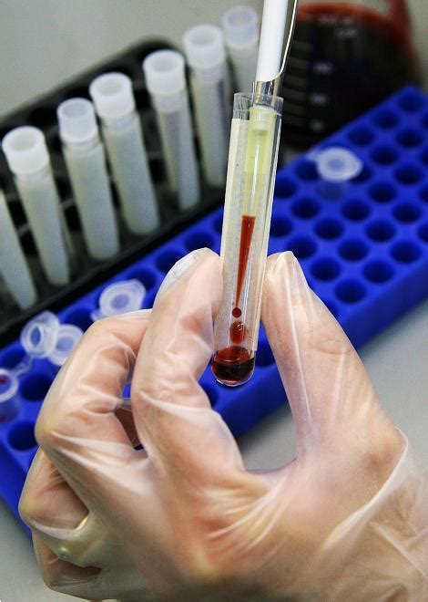 Yes, routine blood work is able to diagnose blood cancers. A Simple Blood Test May Detect Breast Cancer Up to a ...