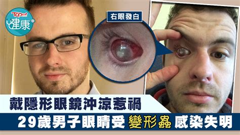 百白破三联疫苗（英語：diphtheria tetanus pertussis vaccine, dpt，港澳台译为白喉破傷風百日咳混合疫苗），是指百日咳、白喉、破伤风混合的疫苗（三合一疫苗）。 29歲男記者戴隱形眼鏡沖涼 右眼受變形蟲感染發白失明 - 香港經濟日報 - TOPick - 健康 - 健康資訊 - D190711