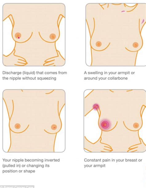 After the procedure, a pathologist examines the removed tissue to check for remaining cancer cells in the lumpectomy margins. About Breast Cancer - Manx Breast Cancer Support Group