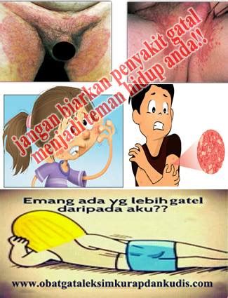 Untuk mengobati infeksi jamur pada vagina, hindari celana, terutama celana dalam yang basah. Saat lari paha terasa gatal | Obat selangkangan berjamur