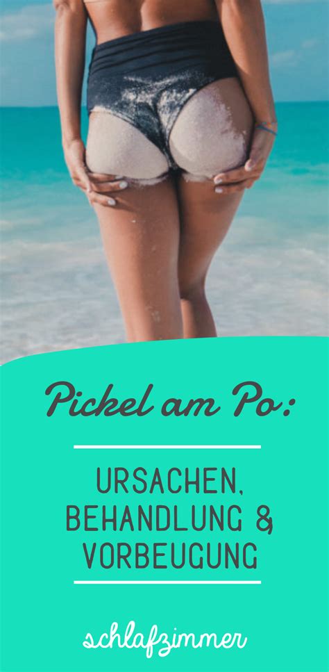 Starker schmerz, schwellung und rötung der. Pin auf Beauty & Lifestyle ♥