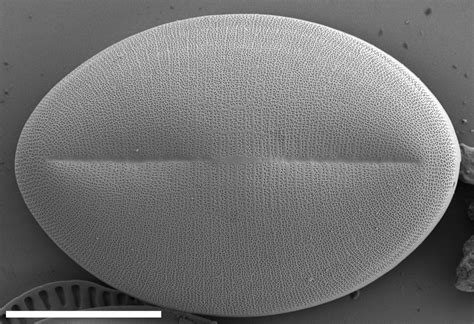 Colocolostomy closure using proximate linear cutters and proximate reloadable staplers (tx) video. Cocconeis pediculus | Species - Diatoms of North America