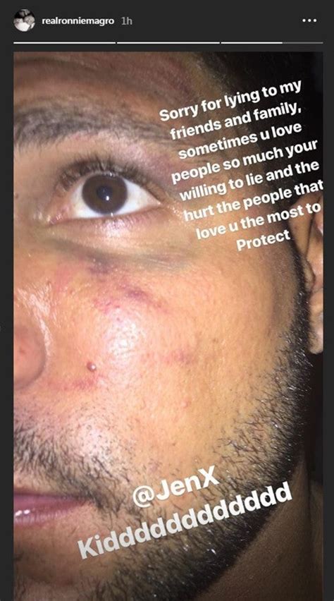 Ingramer has the tool for saving images, igtv, stories along with videos. Ronnie Ortiz-Magro Shares Black Eye, Appears to Blame ...