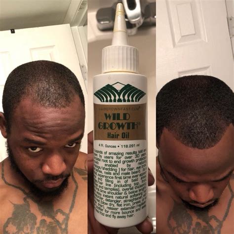 Wild growth oil results and honest review, does wild growth oil really work. Before And After