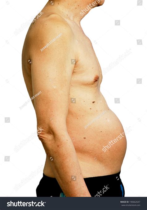 Other symptoms are swelling of the eyes or eyelids and lips, stomach cramps, and difficulty breathing. Bloated Stomach Weight Gain Overweight Fat Stock Photo ...