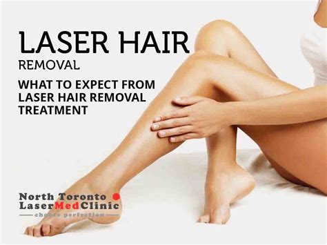 What to expect after brazilian laser hair removal treatment. What to Expect from Laser Hair Removal Treatment | North ...
