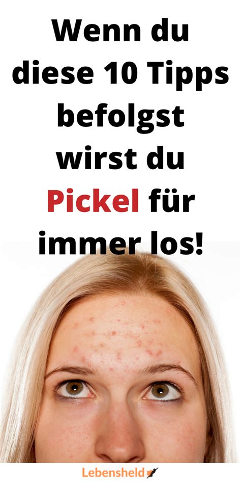 Wer das microneedling gegen falten anwendet, sollte das microneedling alle zwei wochen mindestens sechsmal anwenden, um ergebnisse zu sehen. 10 Tipps gegen Pickel - Was dir endlich hilft in 2020 (mit ...