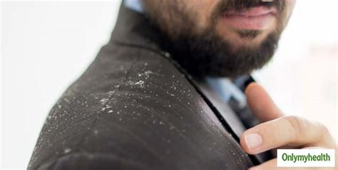 Totex hair gel extra strong. 4 Shocking Side-Effects Of Using Hair Gels Regularly