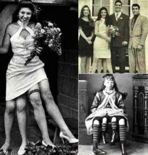 Josephene myrtle corbin nació en 1868. Conheça a história de Myrtle Corbin, a mulher de quatro pernas