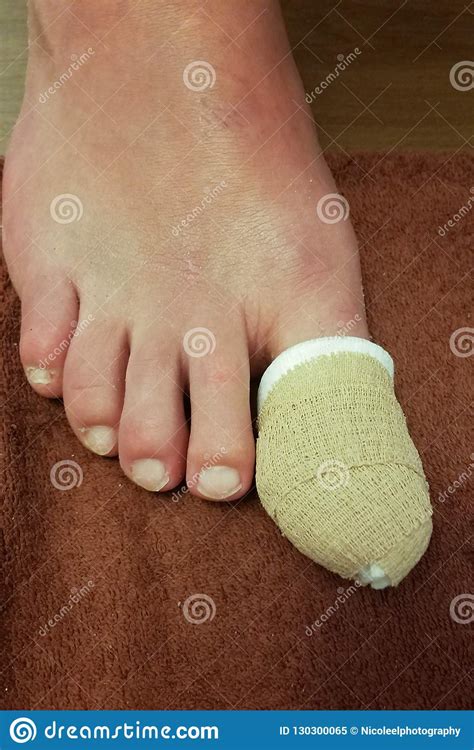 Grande Toe Injury Wrapped E Protegido Imagem de Stock ...
