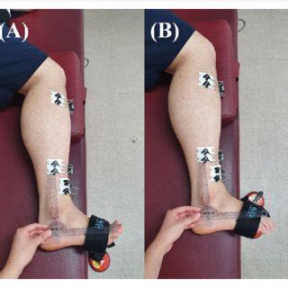 Indications for foot mri scan. MRI with user outlined plantar intrinsic and extrinsic ...