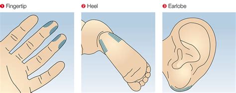 All blood collection services now require booked appointments. Tip of the month: Capillary blood collection - Sarstedt