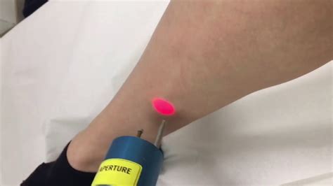 Laser hair removal can be dangerous in inexperienced hands. Skintology by Dr. Jennifer Walden NYC | Laser Hair Removal ...