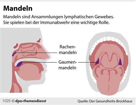 Auch vergrößerte mandeln sollten raus. Ständige Entzündungen: Wann müssen die Mandeln raus ...