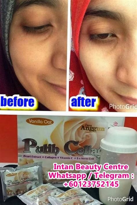 Sel darah putih yang memiliki bentuk pada komponen darah. Putih Collagen dara Anggun : Kulit Lebih Cantik , Gebu ...