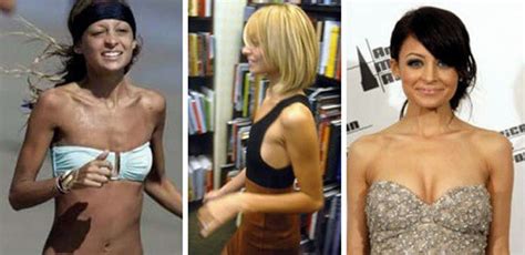 The simple life alum nicole richie celebrated her petite frame on the red carpet in 2006. Celebs with the Worst Fake Breasts: Before and After (14 ...